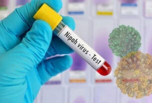 দেশে নিপাহ ভাইরাসে এক নারীর মৃত্যু, সতর্কবার্তা বিশ্ব স্বাস্থ্য সংস্থার