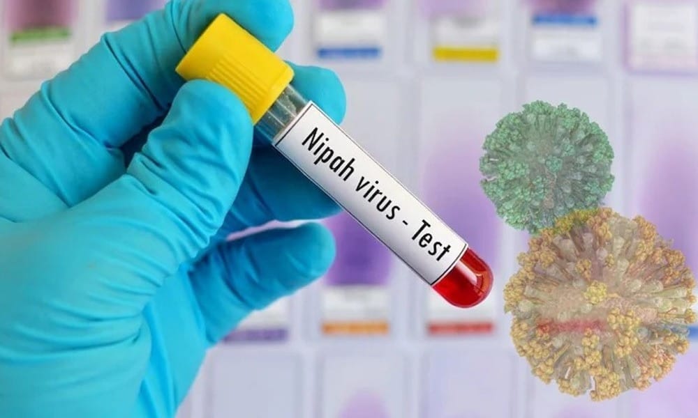 দেশে নিপাহ ভাইরাসে এক নারীর মৃত্যু, সতর্কবার্তা বিশ্ব স্বাস্থ্য সংস্থার