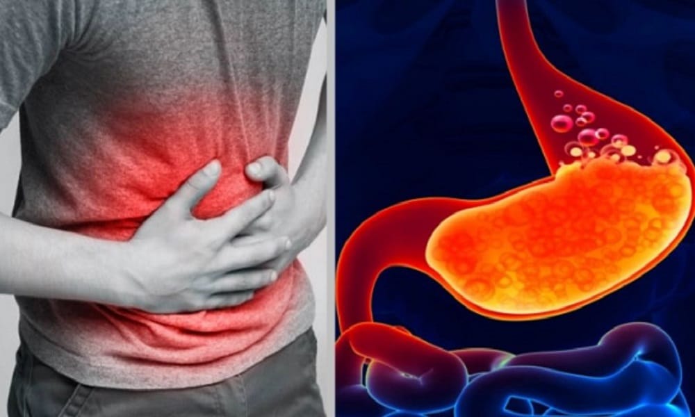 রমজানে গ্যাস্ট্রিক ও অ্যাসিডিটির সমস্যা প্রকট, সহজ সমাধান যেভাবে